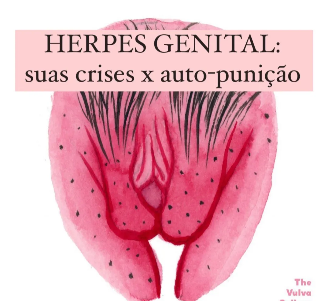 Herpes Genital Suas Crises x Auto punicao