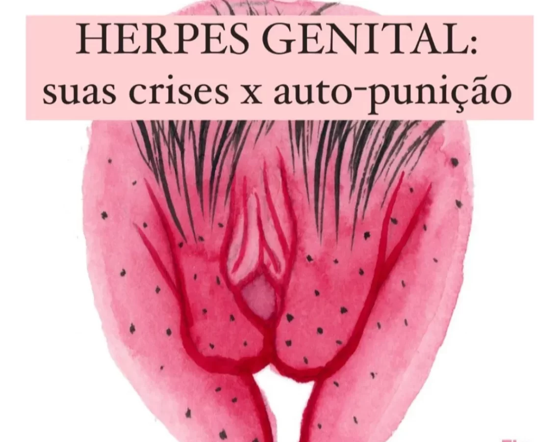 Herpes Genital Suas Crises x Auto-punição